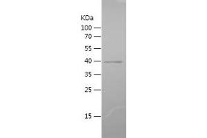 Western Blotting (WB) image for Protein Kinase C, zeta (PRKCZ) (AA 454-592) protein (His-IF2DI Tag) (ABIN7124655) (PKC zeta Protein (AA 454-592) (His-IF2DI Tag))