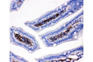 IHC analysis of CD9 using anti-CD9 antibody (ABIN4886531).