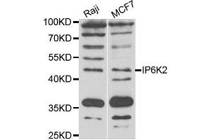 Western blot analysis of extracts of Raji and MCF7 cell lines, using IP6K2 antibody.