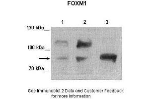 Western Blotting (WB) image for anti-Forkhead Box M1 (FOXM1) (Middle Region) antibody (ABIN2792172)