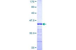 Plakophilin 4 Protein (PKP4) (AA 12-110) (GST tag)