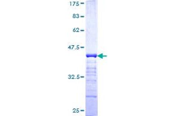 Plakophilin 4 Protein (PKP4) (AA 12-110) (GST tag)