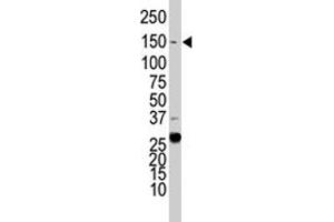 Western blot analysis of KDR polyclonal antibody  in HeLa cell lysate. (VEGFR2/CD309 antibody  (C-Term))