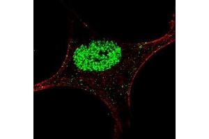 Fluorescent confocal image of an SY5Y cell stained with (ABIN389668 and ABIN2839647) Phospho-STAT5a antibody. (STAT5A antibody  (pTyr694))