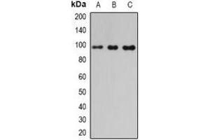 Western blot analysis of PDE6-beta expression in mouse pancreas (A), mouse heart (B), rat liver (C) whole cell lysates. (PDE6B antibody)
