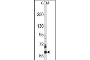 NOX5 Antibody (C-term) (ABIN657889 and ABIN2846842) western blot analysis in CEM cell line lysates (35 μg/lane).