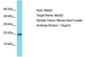 Image no. 1 for anti-Mitochondrial Ribosomal Protein L22 (MRPL22) (AA 108-157) antibody (ABIN6750490) (MRPL22 antibody  (AA 108-157))