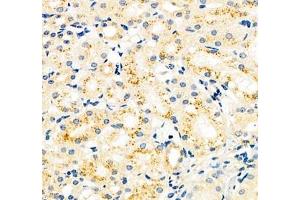Immunohistochemistry of paraffin embedded mouse kidney using CYP20A1 (ABIN7073675) at dilution of 1: 700 (400x lens) (CYP20A1 antibody)