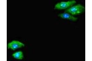 Immunofluorescent analysis of HepG2 cells using ABIN7146992 at dilution of 1:100 and Alexa Fluor 488-congugated AffiniPure Goat Anti-Rabbit IgG(H+L) (CTNND2 antibody  (AA 4-308))