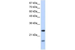 SRP14 antibody used at 1.