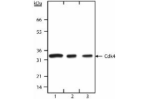 Western blot analysis of Cdk4. (CDK4 antibody  (N-Term))