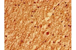 Immunohistochemistry of paraffin-embedded human brain tissue using ABIN7174184 at dilution of 1:100 (LSM1 antibody  (AA 1-133))