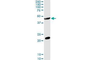 GCNT2 MaxPab rabbit polyclonal antibody. (GCNT2 antibody  (AA 1-402))