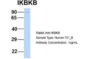Western Blotting (WB) image for anti-Inhibitor of kappa Light Polypeptide Gene Enhancer in B-Cells, Kinase beta (IKBKB) (N-Term) antibody (ABIN2779787)