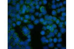 IF analysis of FRMD6 using anti-FRMD6 antibody (ABIN7599577). (FRMD6 antibody  (AA 1-95))