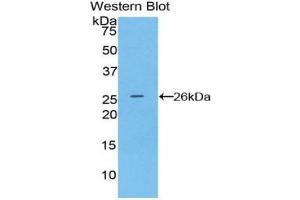 Western blot analysis of recombinant Human CD72. (CD72 antibody  (AA 169-359))
