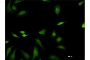 Immunofluorescence of monoclonal antibody to FNTB on HeLa cell. (FNTB antibody  (AA 1-437))