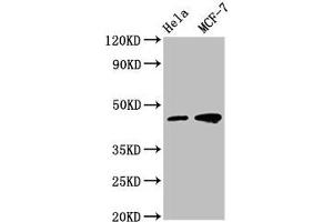 Western Blot Positive WB detected in: Hela whole cell lysate, MCF-7 whole cell lysate All lanes: TSG101 antibody at 1:500 Secondary Goat polyclonal to mouse IgG at 1/50000 dilution Predicted band size: 44, 32 KDa Observed band size: 44 KDa Exposure time:5 min (Tumor Suppressor Gene On Chromosome 11 (TSG11) (AA 1-145) antibody)