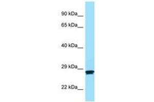 Image no. 1 for anti-Melanocortin 2 Receptor (Adrenocorticotropic Hormone) (MC2R) (AA 86-135) antibody (ABIN6748408) (MC2R antibody  (AA 86-135))