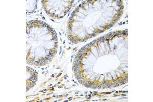 Immunohistochemistry of paraffin-embedded human colon using WNT9A antibody (ABIN5974646) at dilution of 1/100 (40x lens). (WNT9A antibody)