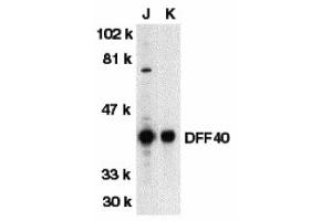Western Blotting (WB) image for anti-DNA Fragmentation Factor, 40kDa, beta Polypeptide (Caspase-Activated DNase) (DFFB) (N-Term) antibody (ABIN1031351) (DFFB antibody  (N-Term))