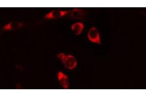 Immunofluorescence (fixed cells) (IF/ICC) image for anti-Interleukin 6 Signal Transducer (Gp130, Oncostatin M Receptor) (IL6ST) (C-Term) antibody (ABIN6260571)