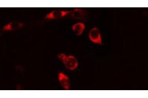 ABIN6269237 staining HeLa cells by IF/ICC. (CD130/gp130 antibody  (C-Term))