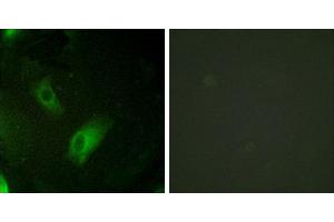 Peptide - +Immunohistochemistry analysis of paraffin-embedded human ovary tissue using IREB1 antibody. (Aconitase 1 antibody  (Internal Region))