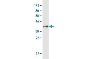 Western Blot detection against Immunogen (36. (IFT74 antibody  (AA 1-100))