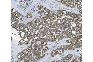 IHC analysis of RAB1B using anti-RAB1B antibody (ABIN7602809). (RAB1B antibody  (C-Term))