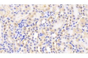 Detection of GR in Mouse Kidney Tissue using Polyclonal Antibody to Glutathione Reductase (GR) (Glutathione Reductase antibody  (AA 240-500))