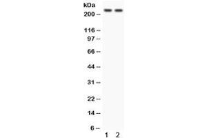 Western blot testing of 1) rat heart and 2) human 293 lysate with Otoferlin antibody.
