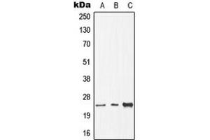 Western blot analysis of CDC8 expression in HEK293T (A), Raw264. (DTYMK antibody  (N-Term))