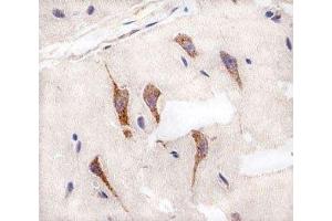 Immunohistochemical analysis of paraffin-embedded human brain using AURKA antibody at 1:25 dilution. (Aurora A antibody)