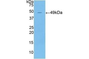 Detection of Recombinant KRT18, Mouse using Polyclonal Antibody to Cytokeratin 18 (CK18) (Cytokeratin 18 antibody  (AA 1-423))