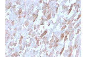 Formalin-fixed, paraffin-embedded human Cardiac Muscle stained with Sarcomeric Actinin Alpha 2 Mouse Monoclonal Antibody (ACTN2/3291). (ACTN2 antibody  (AA 557-692))
