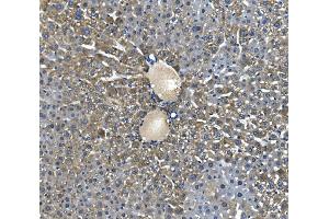 IHC analysis of Glycine decarboxylase/GLDC using anti-Glycine decarboxylase/GLDC antibody (ABIN7602073). (GLDC antibody  (AA 574-1020))