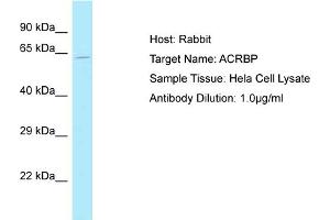 Host: Rabbit Target Name: ACRBP Sample Tissue: Human Hela Whole Cell Antibody Dilution: 1ug/ml (ACRBP antibody  (N-Term))