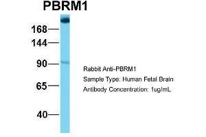 Host: Rabbit Target Name: NOP56 Sample Type: Human Fetal Brain Antibody Dilution: 1. (Polybromo 1 antibody  (Middle Region))