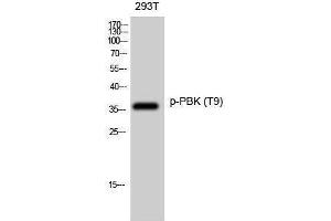 Western Blotting (WB) image for anti-PDZ Binding Kinase (PBK) (pThr9) antibody (ABIN3173023) (PBK antibody  (pThr9))