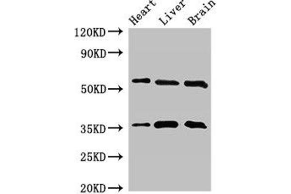 STK35 anticorps  (AA 1-200)