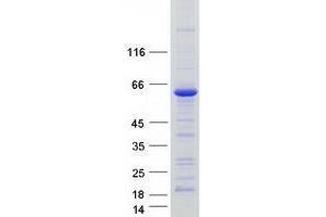 Western Blotting (WB) image for Tricellulin (MARVELD2) (Transcript Variant 1) protein (Myc-DYKDDDDK Tag) (ABIN2734221)