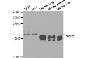 Western blot analysis of extracts of various cell lines, using NPC2 antibody. (NPC2 antibody)