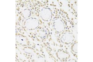 Immunohistochemistry (Paraffin-embedded Sections) (IHC (p)) image for anti-Small Nuclear Ribonucleoprotein Polypeptide A (SNRPA) (AA 1-282) antibody (ABIN6148210)