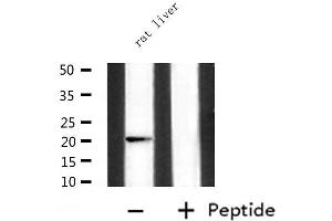 Western blot analysis of extracts from rat liver, using IGF2 Antibody.