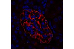 SYNPO antibody  (Isoform 2)