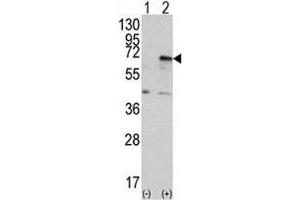Western blot analysis of PRKR antibody and 293 cell lysate (2 ug/lane) either nontransfected (Lane 1) or transiently transfected with the EIF2AK2/PKR gene (2). (EIF2AK2 antibody  (AA 519-550))