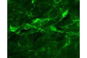 Immunofluorescent staining of rat basal forebrain cholinergic neurons using Ngfr monoclonal antibody, clone MC192 (FITC) , following intraventricullar delivery (5 ug). (NGFR antibody  (FITC))