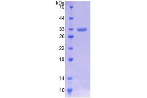 SDS-PAGE (SDS) image for Lactate Dehydrogenase A (LDHA) (AA 1-332) protein (His tag) (ABIN1080192) (Lactate Dehydrogenase A Protein (LDHA) (AA 1-332) (His tag))