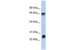 C1ORF103 antibody used at 1 ug/ml to detect target protein. (C1orf103 antibody  (N-Term))
